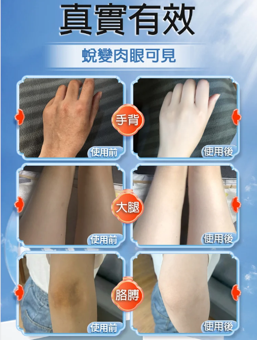 【拯救黑肌膚】火爆活動#買一贈二 全身一洗白沐浴乳！暢銷海外，全身適用，告別肌膚暗沈！夏季更要做白的出眾的仙女！