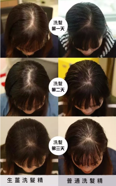 生薑養髮洗鬢乳，溫和無刺激 促進頭皮的血液循環，用它洗頭 頭鬟暴增 濃密黑亮 頭鬢更加滋潤保濕有光澤